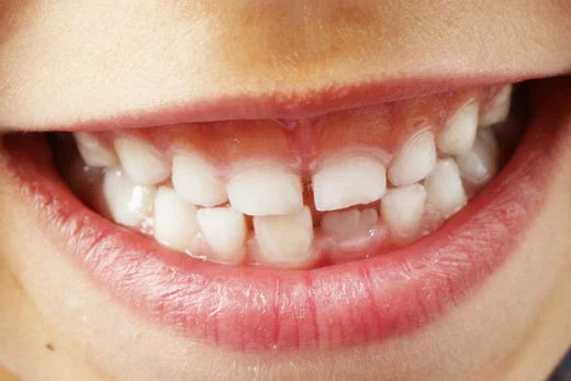 Visiting Pharmacies For Oral Pain | brush baby toothbrushes